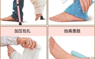 扭伤处理常识 - 扭伤处置方法