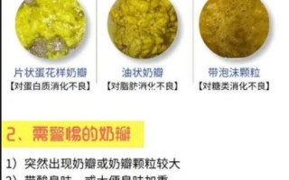 婴儿正常大便颜色常识图解 - 婴儿正常大便颜色和形状