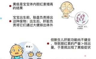 宝宝黄疸常识（宝宝黄疸常识图）