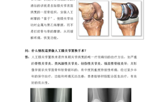 控制置换常识，控制置换常识有哪些