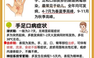 手足口病的预防和常识，手足口病预防小知识