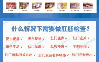 痔疮常识判断（痔疮怎么诊断）