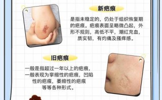 疤痕预防常识，疤痕预防需要注意什么