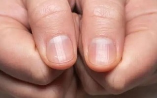 指甲医学常识，指甲的医学知识
