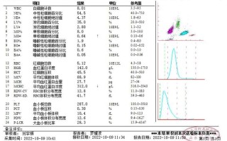 甲状腺结节常识（甲状腺结节知识点）