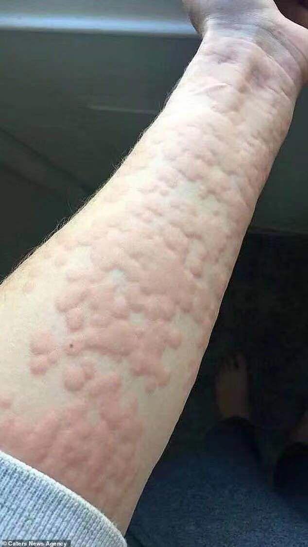 麻疹常识视频,麻疹小知识-第1张图片-牛逼常识网 麻疹常识视频,麻疹小知识-第1张图片-牛逼常识网