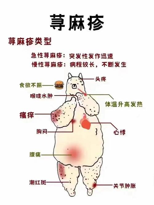 麻疹常识视频,麻疹小知识-第4张图片-牛逼常识网 麻疹常识视频,麻疹小知识-第4张图片-牛逼常识网