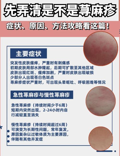 麻疹常识视频,麻疹小知识-第6张图片-牛逼常识网 麻疹常识视频,麻疹小知识-第6张图片-牛逼常识网