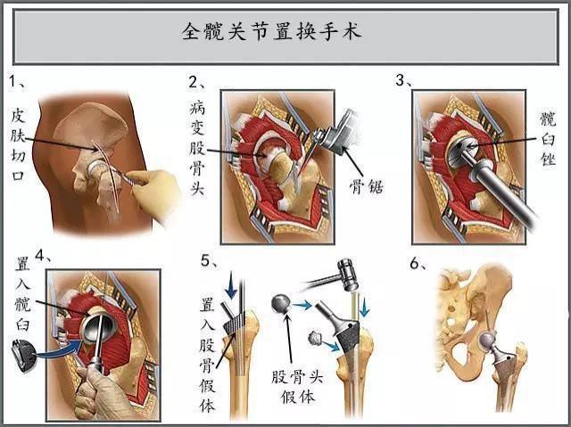 控制置换常识,控制置换常识有哪些-第3张图片-牛逼常识网 控制置换常识,控制置换常识有哪些-第3张图片-牛逼常识网