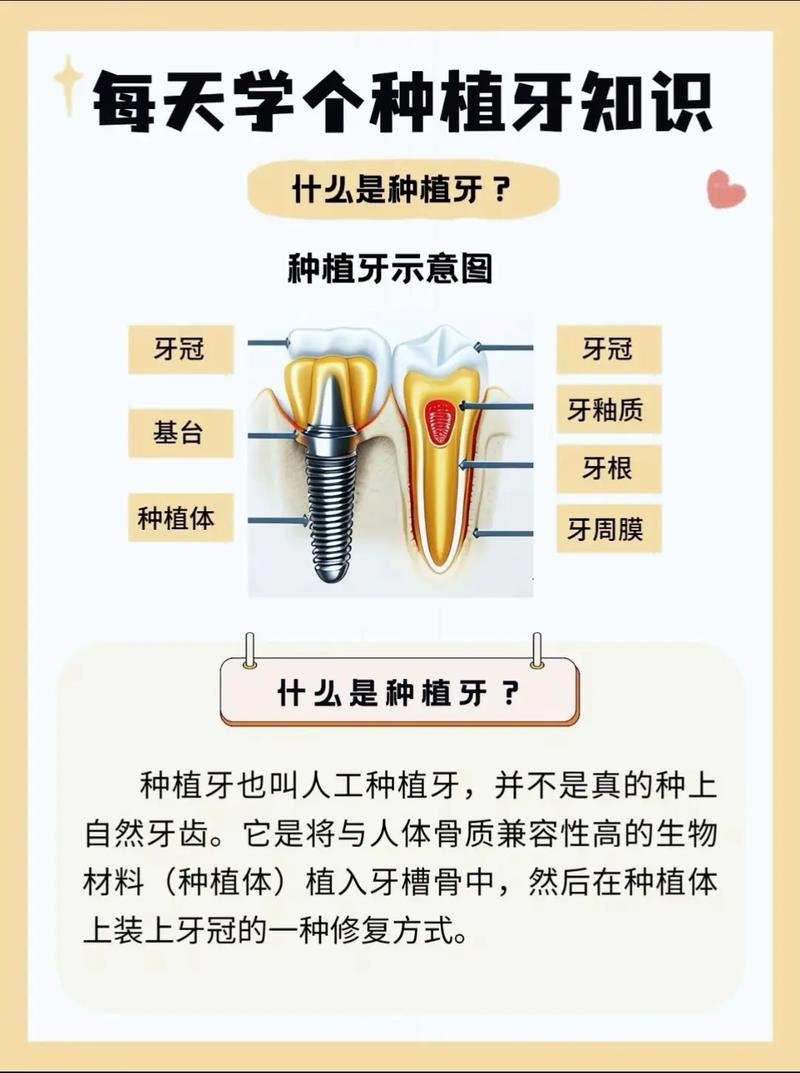 牙科常识知识,牙科知识小课堂-第3张图片-牛逼常识网 牙科常识知识,牙科知识小课堂-第3张图片-牛逼常识网