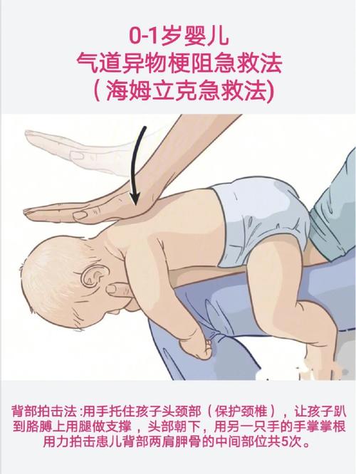 急救常识标题(急救知识标题)-第3张图片-牛逼常识网 急救常识标题(急救知识标题)-第3张图片-牛逼常识网