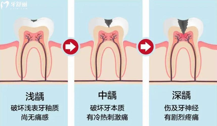 牙科基础常识(牙科知识科普)-第3张图片-牛逼常识网 牙科基础常识(牙科知识科普)-第3张图片-牛逼常识网
