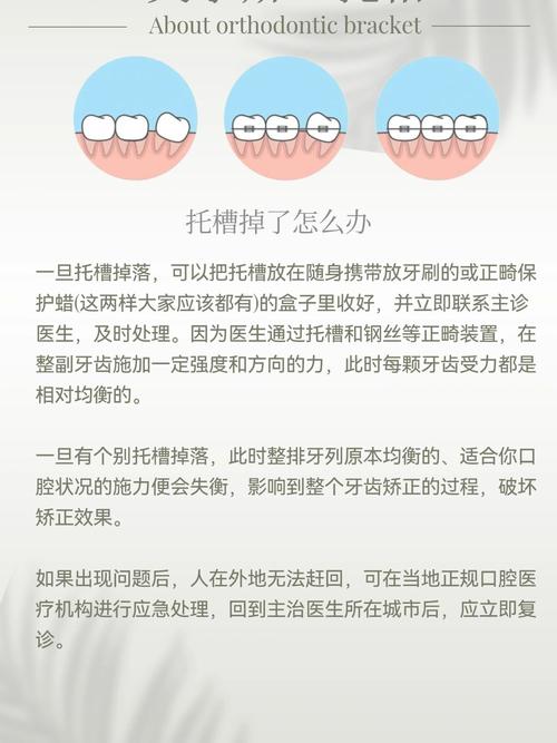矫正牙齿常识(矫正牙齿的一些问题)-第3张图片-牛逼常识网 矫正牙齿常识(矫正牙齿的一些问题)-第3张图片-牛逼常识网