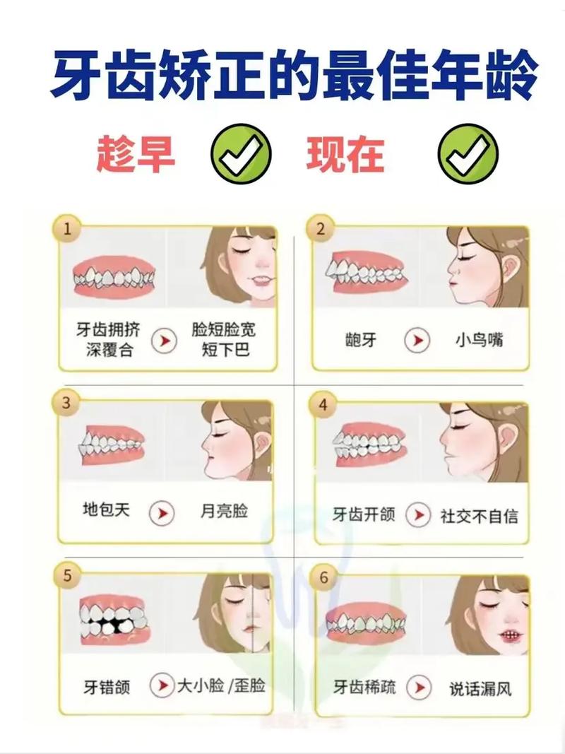 矫正牙齿常识(矫正牙齿的一些问题)-第4张图片-牛逼常识网 矫正牙齿常识(矫正牙齿的一些问题)-第4张图片-牛逼常识网