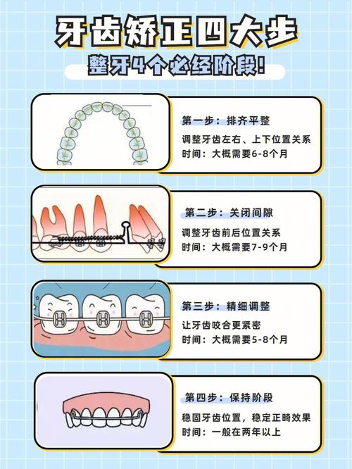 矫正牙齿常识(矫正牙齿的一些问题)-第7张图片-牛逼常识网 矫正牙齿常识(矫正牙齿的一些问题)-第7张图片-牛逼常识网