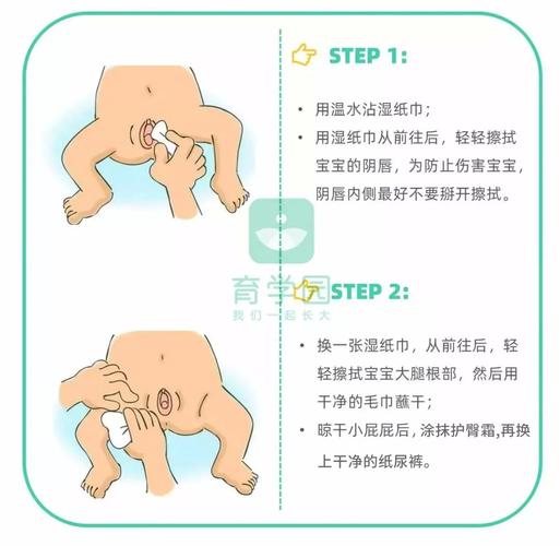 尿路感染常识,尿路感染常识有哪些-第5张图片-牛逼常识网 尿路感染常识,尿路感染常识有哪些-第5张图片-牛逼常识网