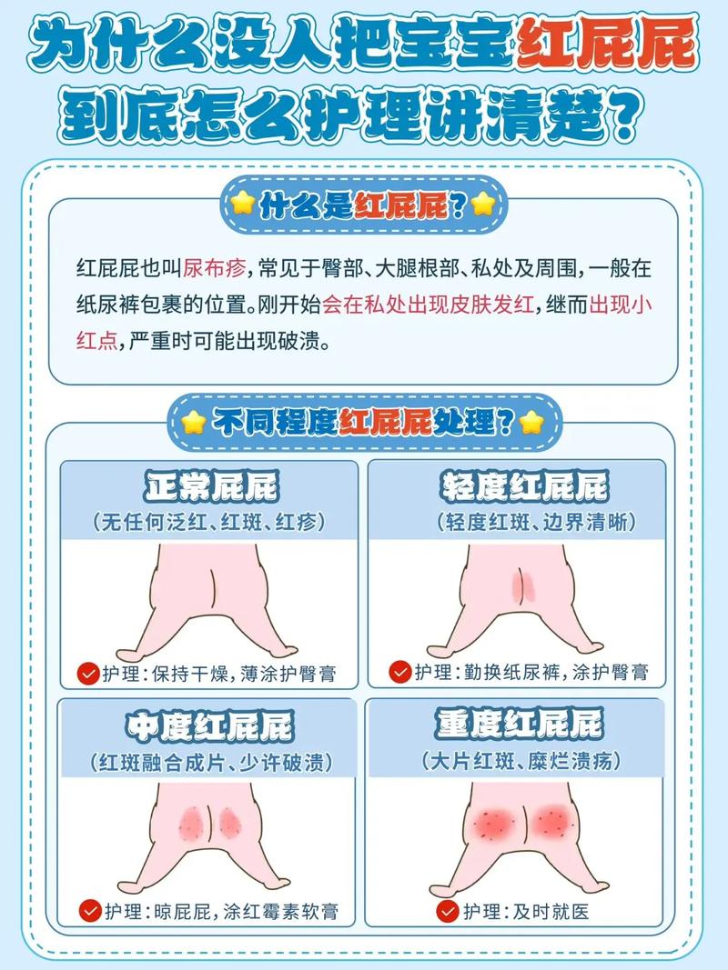 新生儿红屁屁护理常识(新生儿红屁股的护理)-第5张图片-牛逼常识网 新生儿红屁屁护理常识(新生儿红屁股的护理)-第5张图片-牛逼常识网
