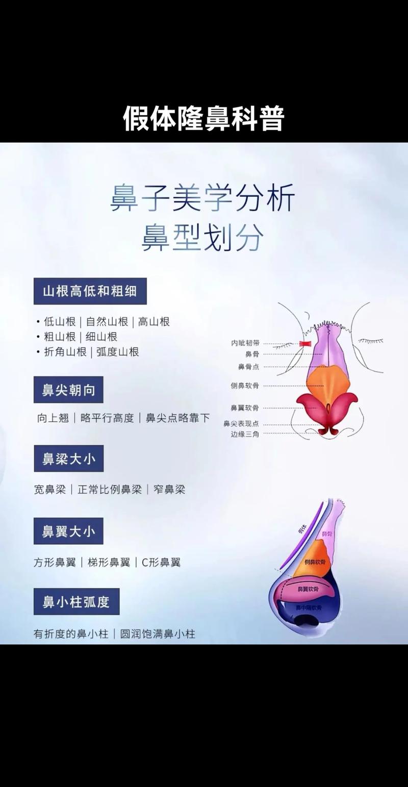 隆鼻常识医院(隆鼻常识医院能做吗)-第3张图片-牛逼常识网 隆鼻常识医院(隆鼻常识医院能做吗)-第3张图片-牛逼常识网