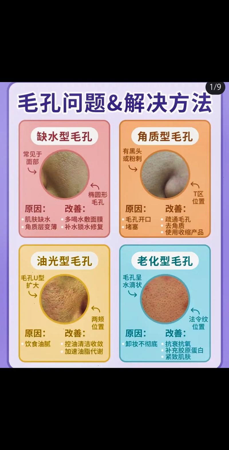 收缩毛孔常识 - 收缩毛孔的好处和坏处-第4张图片-牛逼常识网 收缩毛孔常识 - 收缩毛孔的好处和坏处-第4张图片-牛逼常识网