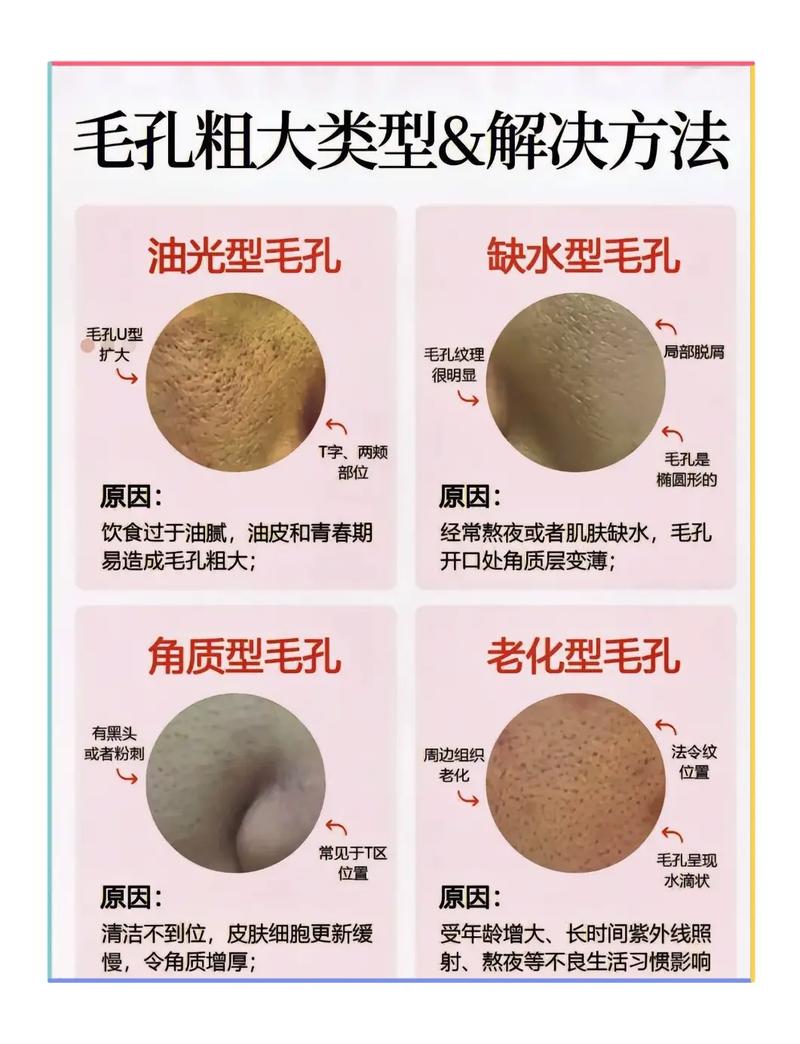收缩毛孔常识 - 收缩毛孔的好处和坏处-第5张图片-牛逼常识网 收缩毛孔常识 - 收缩毛孔的好处和坏处-第5张图片-牛逼常识网