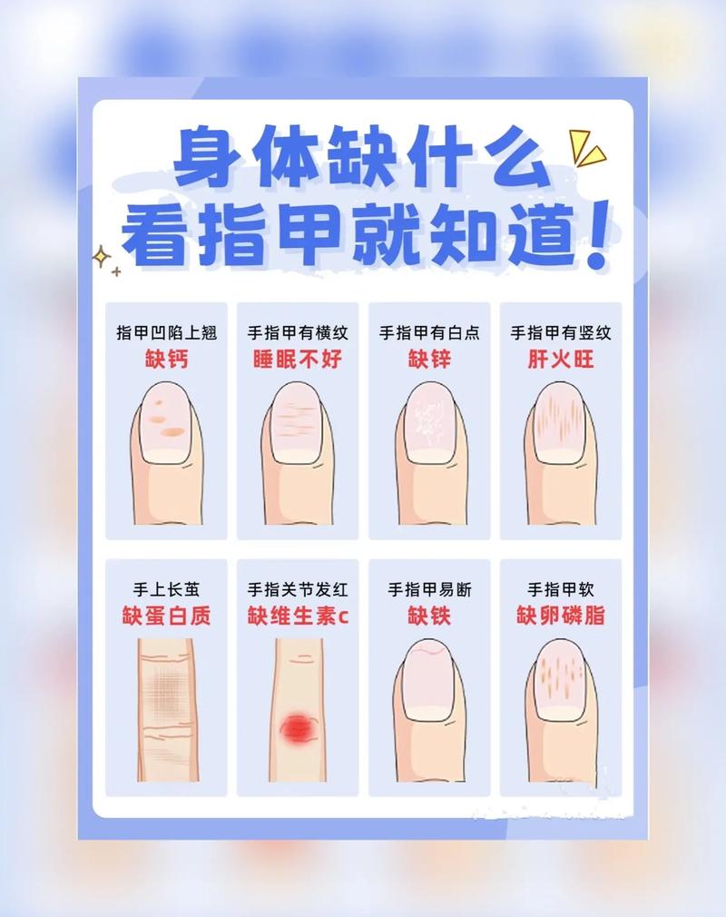 指甲生长常识(指甲生长原理图解)-第1张图片-牛逼常识网 指甲生长常识(指甲生长原理图解)-第1张图片-牛逼常识网