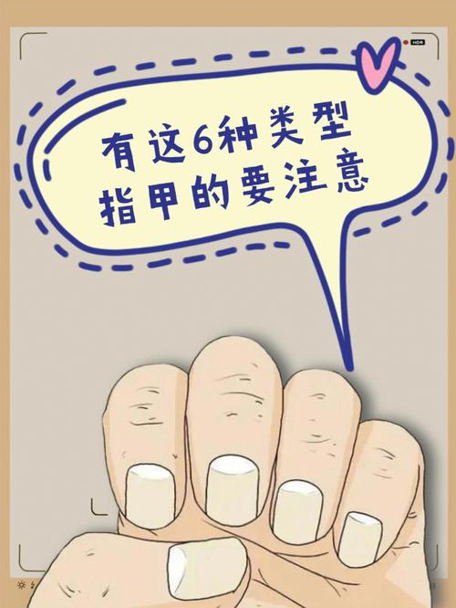 指甲生长常识(指甲生长原理图解)-第6张图片-牛逼常识网 指甲生长常识(指甲生长原理图解)-第6张图片-牛逼常识网