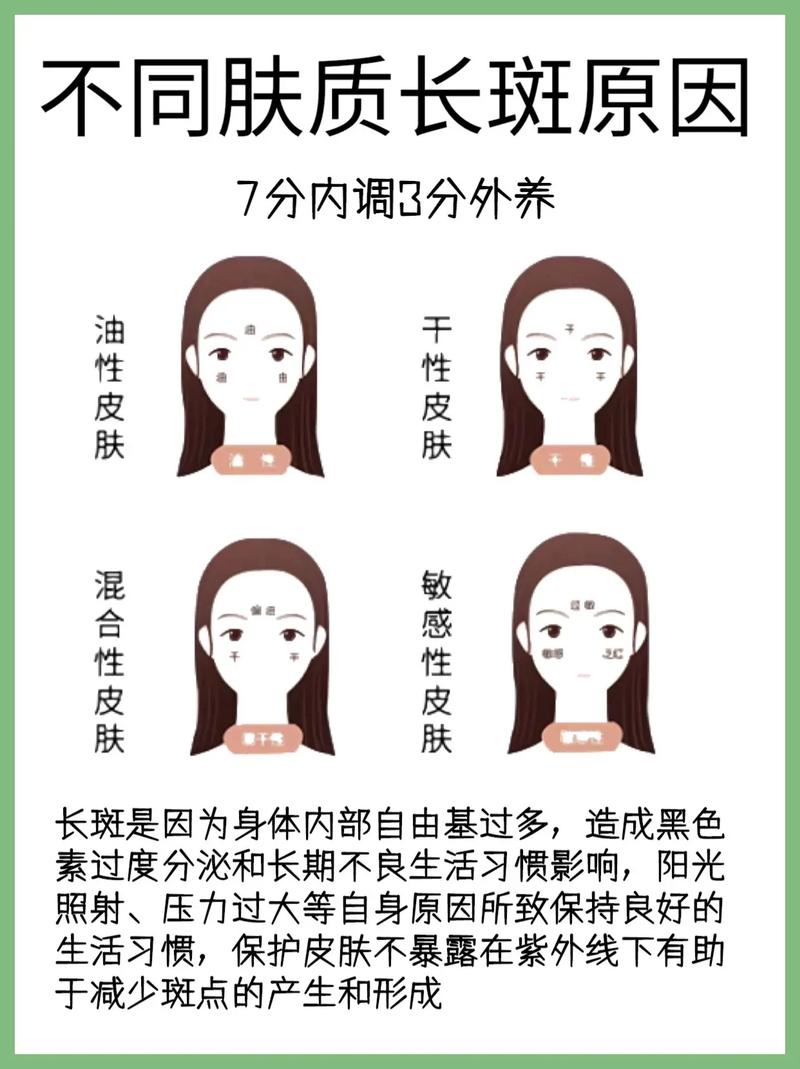 关于淡斑常识,淡斑护理的好处-第2张图片-牛逼常识网 关于淡斑常识,淡斑护理的好处-第2张图片-牛逼常识网