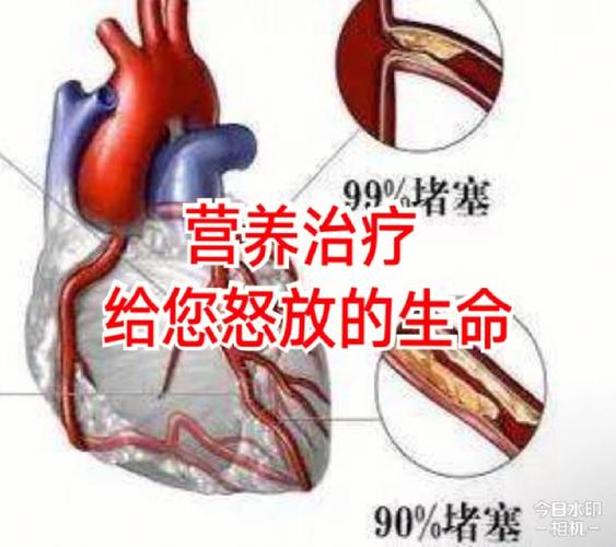 心脏养护常识 - 心脏养护常识内容-第2张图片-牛逼常识网 心脏养护常识 - 心脏养护常识内容-第2张图片-牛逼常识网