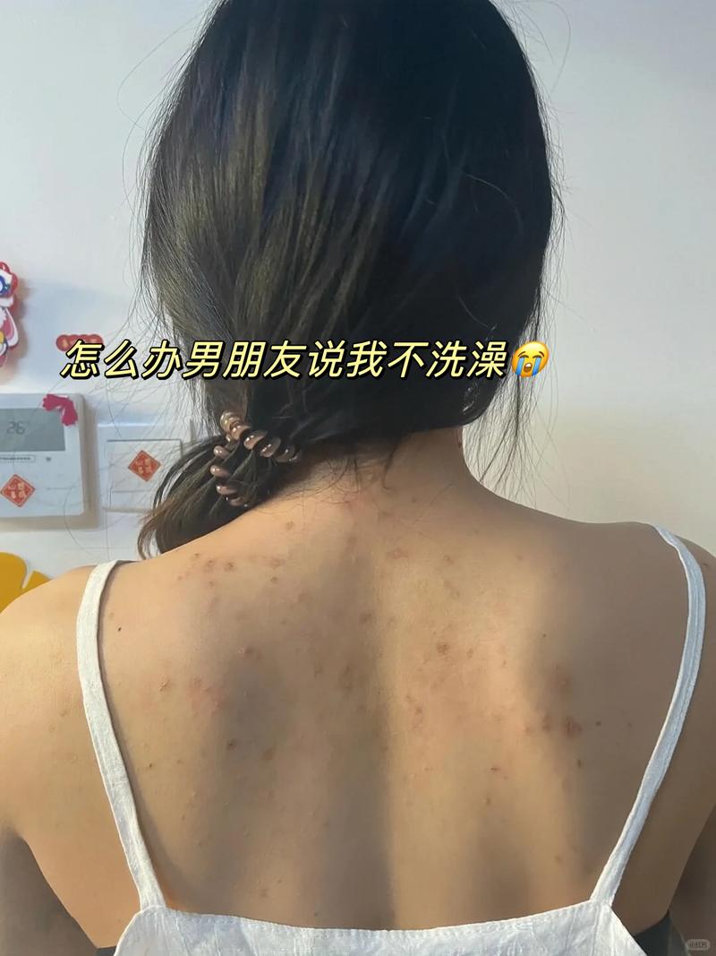 小孩背常识痒 - 孩子背痒-第2张图片-牛逼常识网 小孩背常识痒 - 孩子背痒-第2张图片-牛逼常识网