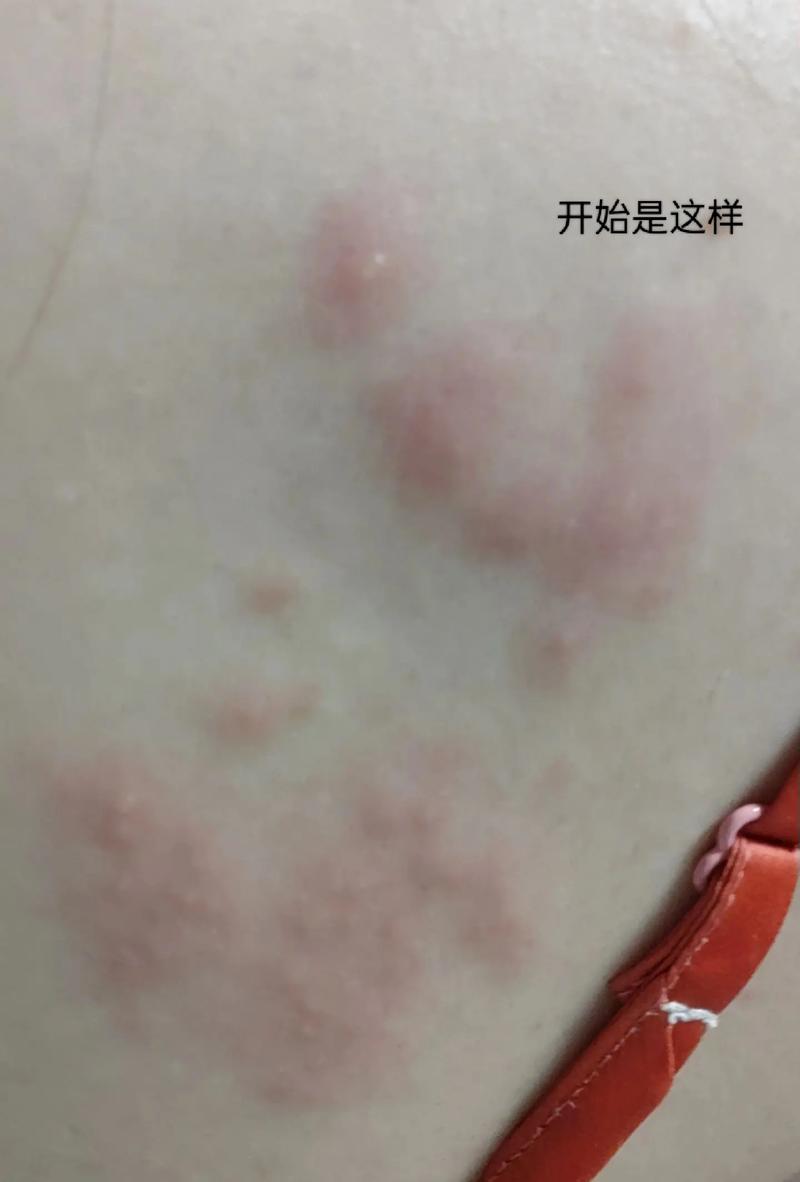 小孩背常识痒 - 孩子背痒-第4张图片-牛逼常识网 小孩背常识痒 - 孩子背痒-第4张图片-牛逼常识网