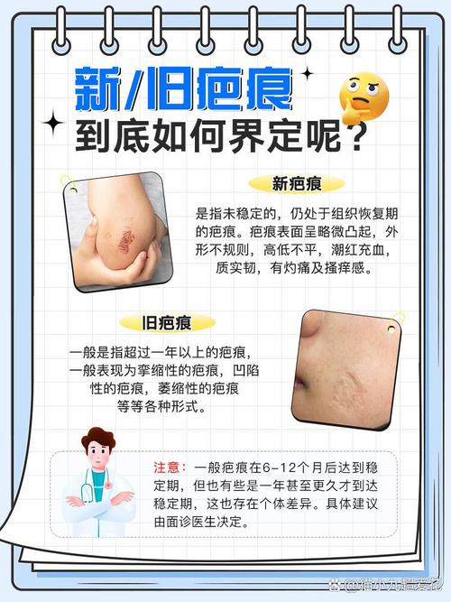 疤痕预防常识,疤痕预防需要注意什么-第1张图片-牛逼常识网 疤痕预防常识,疤痕预防需要注意什么-第1张图片-牛逼常识网