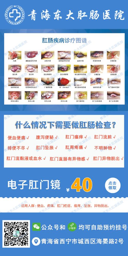 痔疮常识判断(痔疮怎么诊断)-第1张图片-牛逼常识网 痔疮常识判断(痔疮怎么诊断)-第1张图片-牛逼常识网