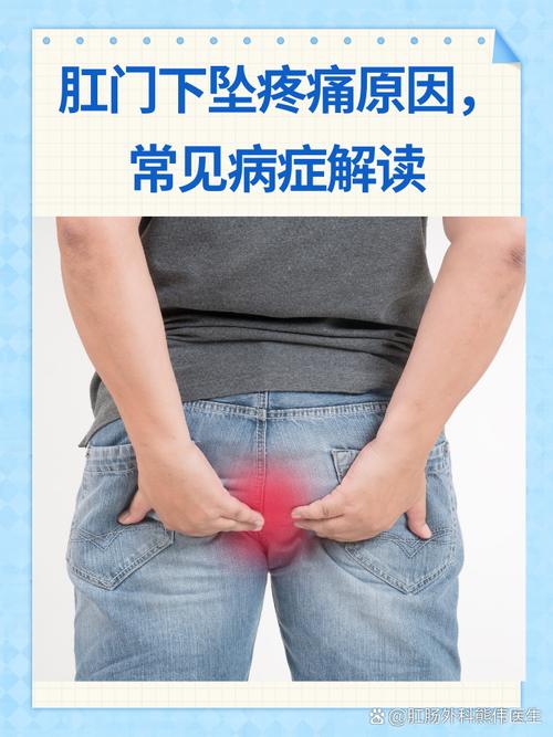 痔疮常识判断(痔疮怎么诊断)-第3张图片-牛逼常识网 痔疮常识判断(痔疮怎么诊断)-第3张图片-牛逼常识网