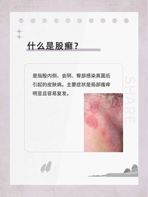 医学常识处理,医学常识知识点-第6张图片-牛逼常识网 医学常识处理,医学常识知识点-第6张图片-牛逼常识网