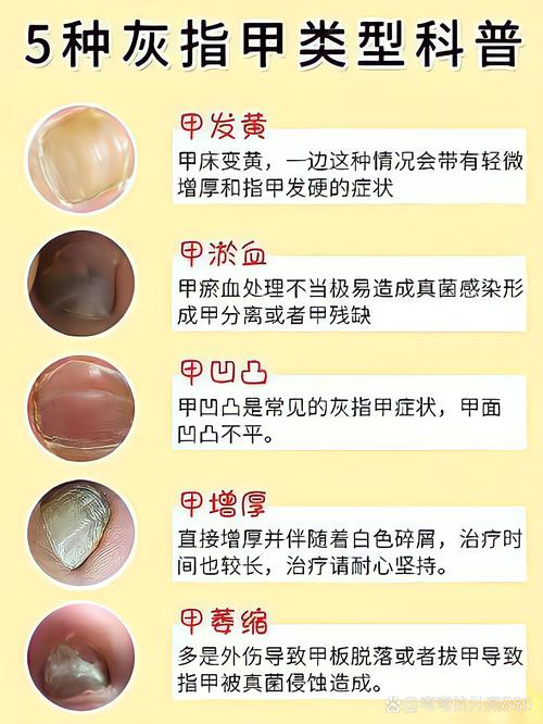 防核战备常识,防核战争物资储备-第4张图片-牛逼常识网 防核战备常识,防核战争物资储备-第4张图片-牛逼常识网