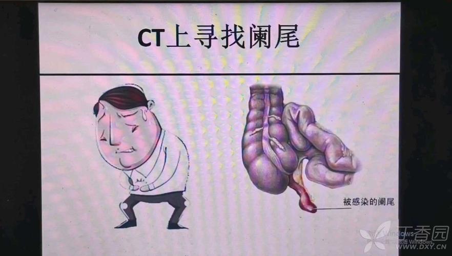 医学手术必备常识(手术基础知识)-第2张图片-牛逼常识网 医学手术必备常识(手术基础知识)-第2张图片-牛逼常识网