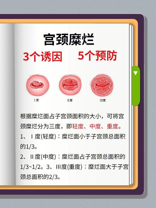 妇科常识医学,妇科知识要点-第4张图片-牛逼常识网 妇科常识医学,妇科知识要点-第4张图片-牛逼常识网