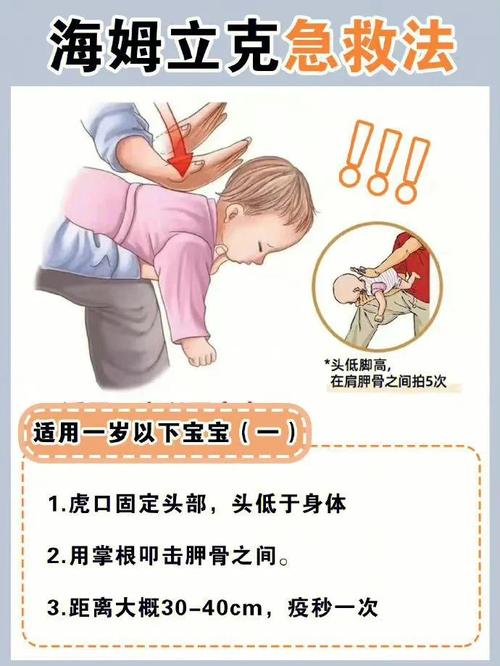 噎食急救常识 - 噎食急救常识大全-第2张图片-牛逼常识网 噎食急救常识 - 噎食急救常识大全-第2张图片-牛逼常识网