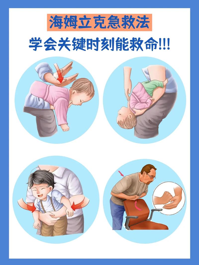 噎食急救常识 - 噎食急救常识大全-第3张图片-牛逼常识网 噎食急救常识 - 噎食急救常识大全-第3张图片-牛逼常识网