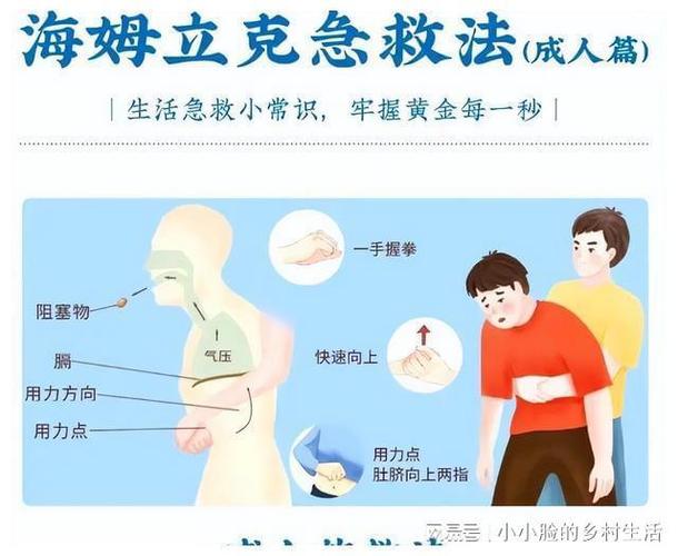 噎食急救常识 - 噎食急救常识大全-第4张图片-牛逼常识网 噎食急救常识 - 噎食急救常识大全-第4张图片-牛逼常识网