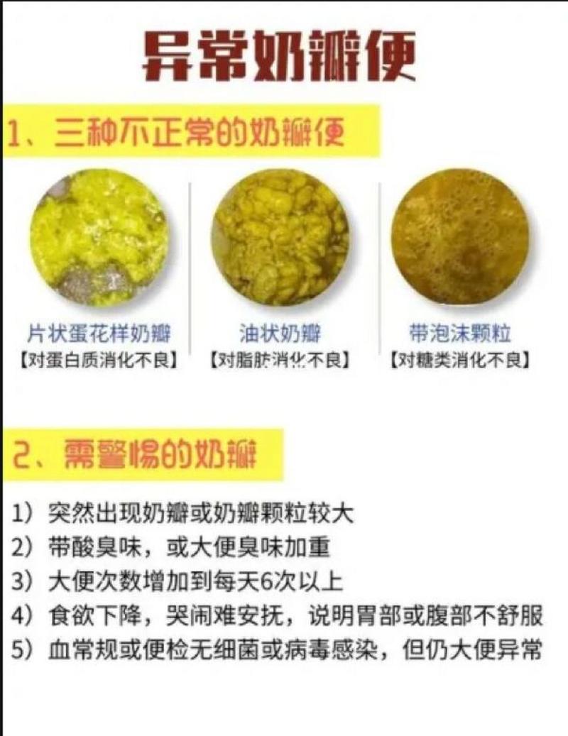 婴儿正常大便颜色常识图解 - 婴儿正常大便颜色和形状-第1张图片-牛逼常识网 婴儿正常大便颜色常识图解 - 婴儿正常大便颜色和形状-第1张图片-牛逼常识网