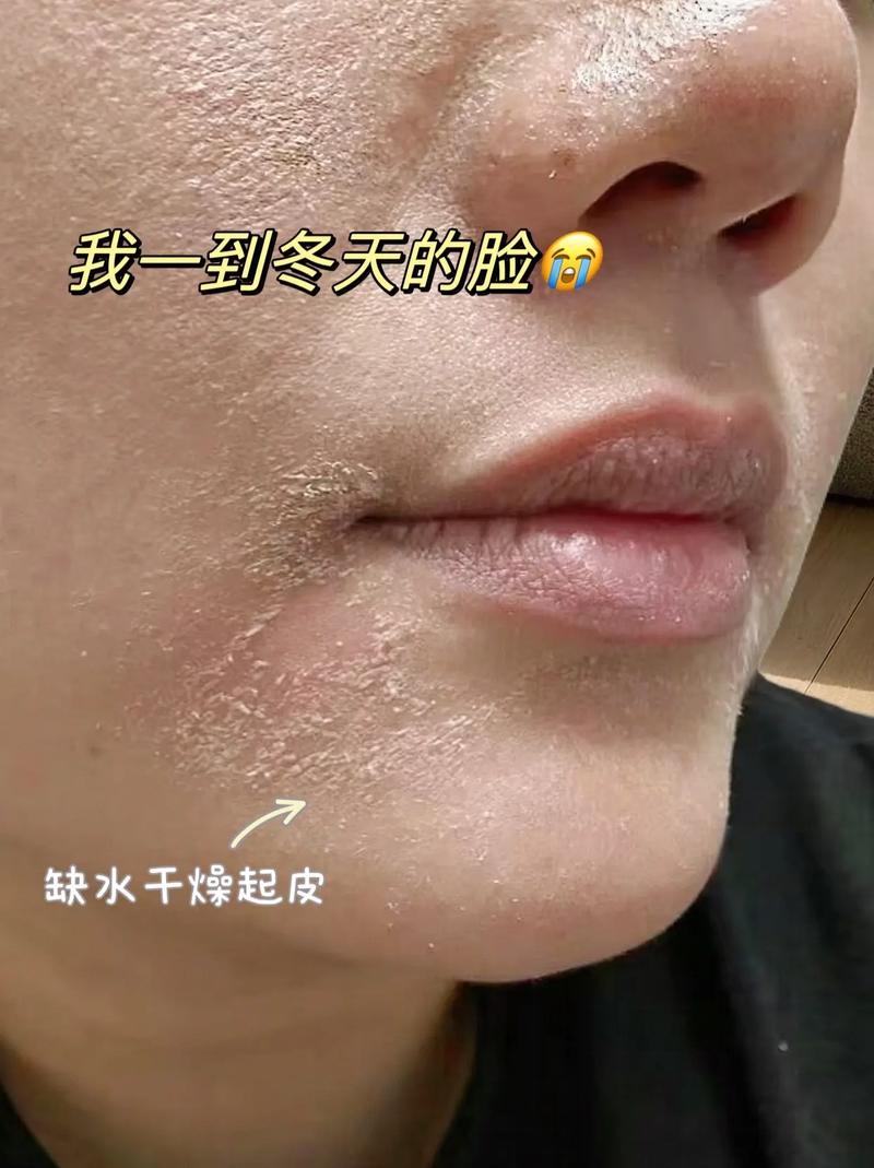 皮肤死皮常识 - 皮肤死皮常识图片-第3张图片-牛逼常识网 皮肤死皮常识 - 皮肤死皮常识图片-第3张图片-牛逼常识网