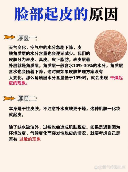 皮肤死皮常识 - 皮肤死皮常识图片-第6张图片-牛逼常识网 皮肤死皮常识 - 皮肤死皮常识图片-第6张图片-牛逼常识网