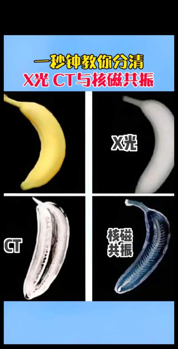 照CT是常识,照ct检查什么-第5张图片-牛逼常识网 照CT是常识,照ct检查什么-第5张图片-牛逼常识网