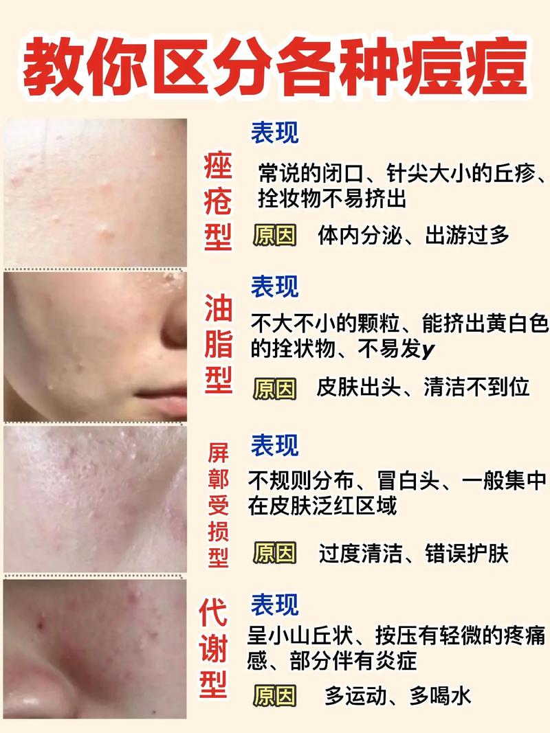 面膜常识合集(面膜小常识1000条)-第7张图片-牛逼常识网 面膜常识合集(面膜小常识1000条)-第7张图片-牛逼常识网