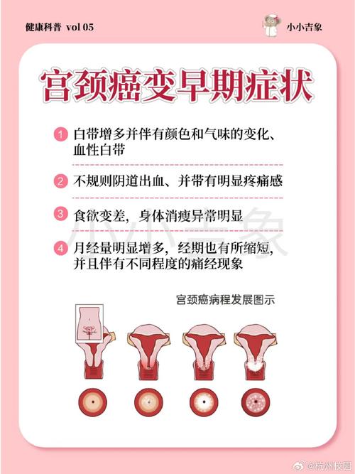 肿瘤基本常识(肿瘤知识常识)-第4张图片-牛逼常识网 肿瘤基本常识(肿瘤知识常识)-第4张图片-牛逼常识网