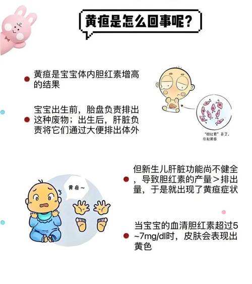 宝宝黄疸常识(宝宝黄疸常识图)-第5张图片-牛逼常识网 宝宝黄疸常识(宝宝黄疸常识图)-第5张图片-牛逼常识网