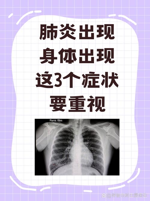 新冠炎症常识(新冠的常识)-第3张图片-牛逼常识网 新冠炎症常识(新冠的常识)-第3张图片-牛逼常识网