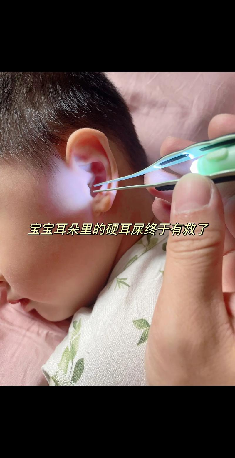 掏耳朵小常识 - 掏耳朵有什么好的方法-第2张图片-牛逼常识网 掏耳朵小常识 - 掏耳朵有什么好的方法-第2张图片-牛逼常识网
