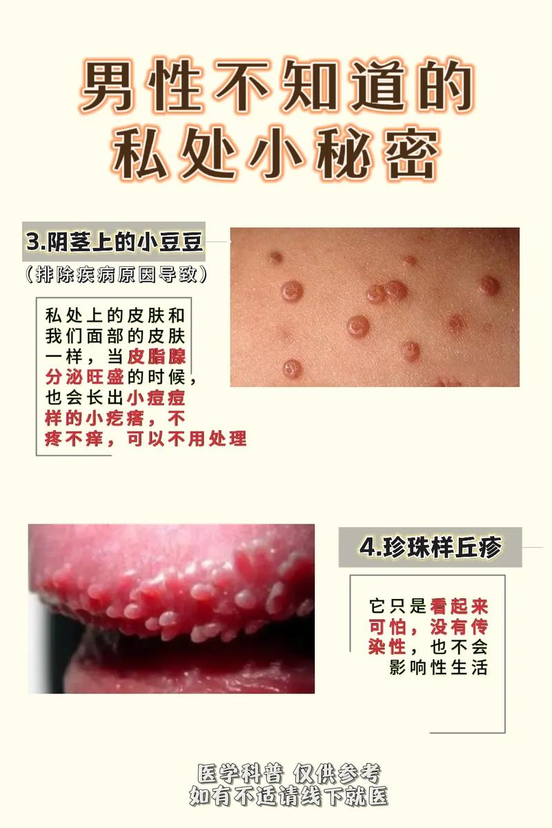 青春期的生理卫生常识 - 青春期的生理卫生常识有哪些-第6张图片-牛逼常识网 青春期的生理卫生常识 - 青春期的生理卫生常识有哪些-第6张图片-牛逼常识网